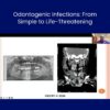 IODCPC 2026 Oral Surgery Preconference Replay Access